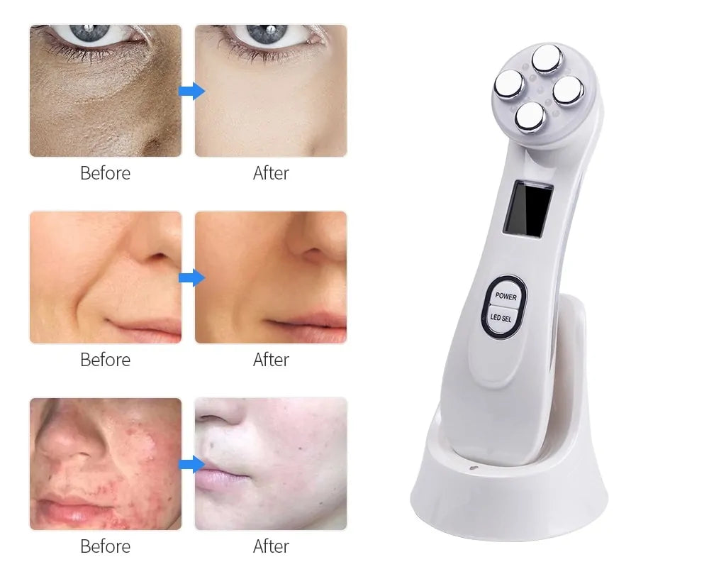 Skin Care Face Massager - Rejuvenate & Enhance Your Skincare Routine - ShopandTop