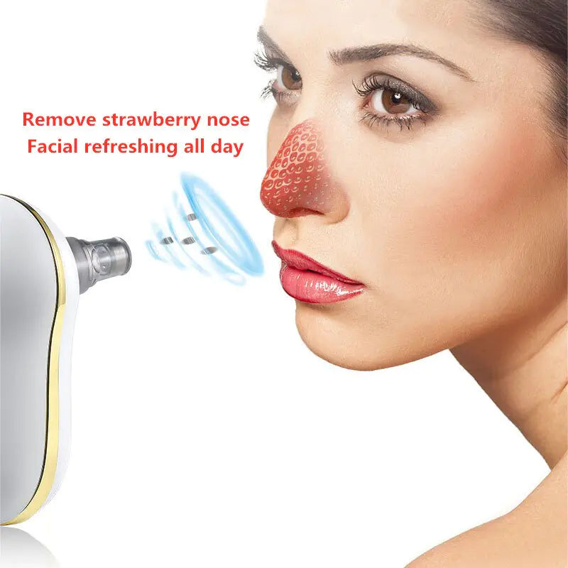 Vacuum Suction Pore Cleaner - Deep Cleansing for Clear, Radiant Skin - ShopandTop