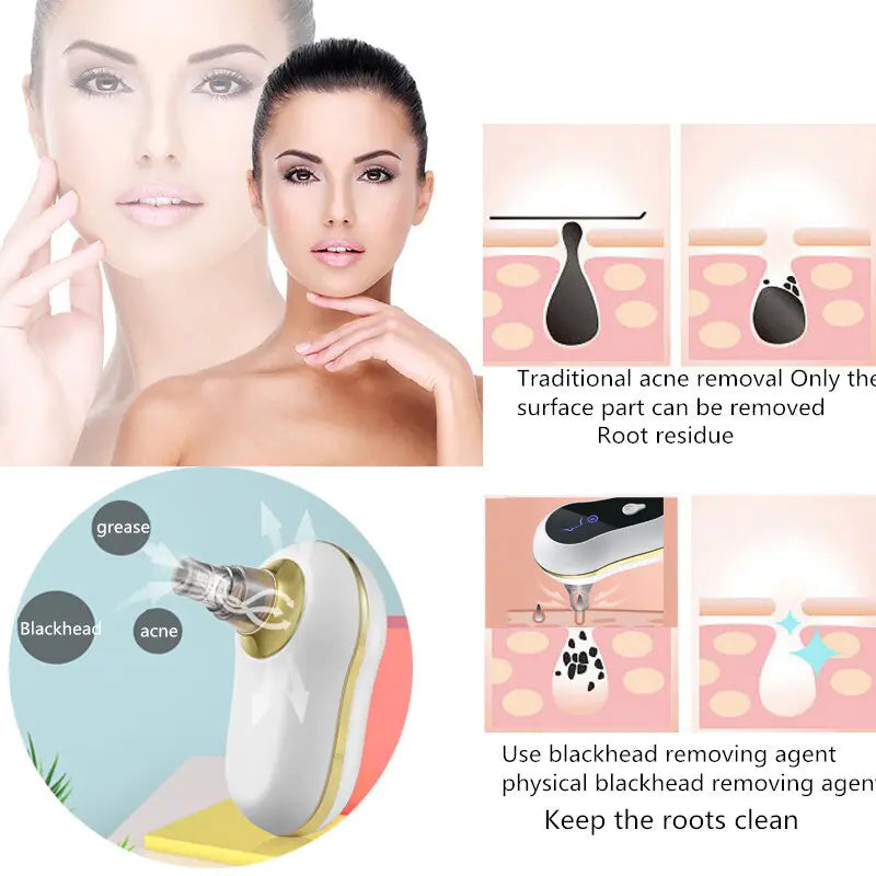 Vacuum Suction Pore Cleaner - Deep Cleansing for Clear, Radiant Skin - ShopandTop